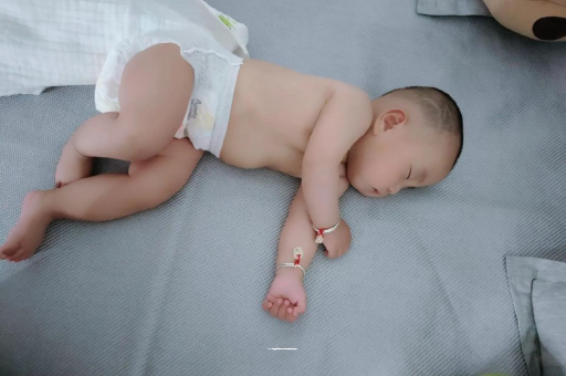 衡阳六个月宝宝眼睛散光